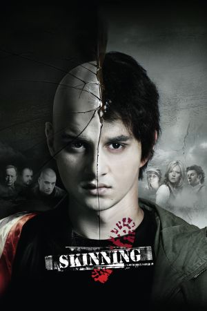 Skinning - Wir sind das Gesetz poster